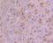 Autophagy Related 9A antibody, NBP2-67616, Novus Biologicals, Immunohistochemistry paraffin image 
