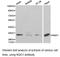 NAD(P)H Quinone Dehydrogenase 1 antibody, LS-C193002, Lifespan Biosciences, Western Blot image 