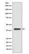 ISL LIM Homeobox 1 antibody, M02969, Boster Biological Technology, Western Blot image 