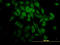 p65 antibody, LS-B13554, Lifespan Biosciences, Immunofluorescence image 