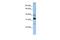 Thioredoxin-related transmembrane protein 4 antibody, GTX46031, GeneTex, Western Blot image 