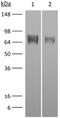 Colony Stimulating Factor 1 Receptor antibody, GTX14566, GeneTex, Western Blot image 