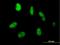 Zinc Finger Protein 331 antibody, H00055422-B01P, Novus Biologicals, Immunofluorescence image 