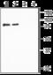 Sodium Channel Epithelial 1 Beta Subunit antibody, GTX16967, GeneTex, Western Blot image 
