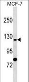 Anion exchange protein 4 antibody, LS-C159021, Lifespan Biosciences, Western Blot image 