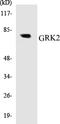 G Protein-Coupled Receptor Kinase 2 antibody, EKC1252, Boster Biological Technology, Western Blot image 