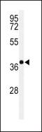 Paired Box 6 antibody, PA5-25970, Invitrogen Antibodies, Western Blot image 