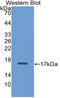 ADAM Metallopeptidase With Thrombospondin Type 1 Motif 2 antibody, LS-C418134, Lifespan Biosciences, Western Blot image 