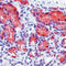 Baculoviral IAP Repeat Containing 5 antibody, LS-C88692, Lifespan Biosciences, Immunohistochemistry paraffin image 