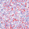 MYB Proto-Oncogene, Transcription Factor antibody, LS-C87830, Lifespan Biosciences, Immunohistochemistry paraffin image 