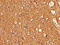 Cyclin Dependent Kinase 5 antibody, LS-C369405, Lifespan Biosciences, Immunohistochemistry paraffin image 