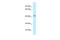 Calcium Voltage-Gated Channel Auxiliary Subunit Gamma 8 antibody, ARP35367_P050, Aviva Systems Biology, Western Blot image 