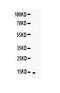 TNF Superfamily Member 18 antibody, A04408-1, Boster Biological Technology, Western Blot image 