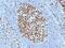 Minichromosome Maintenance Complex Component 7 antibody, 33-735, ProSci, Immunohistochemistry paraffin image 