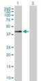 Chondromodulin antibody, H00011061-D01P, Novus Biologicals, Western Blot image 