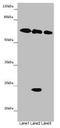 TOX High Mobility Group Box Family Member 3 antibody, LS-C679863, Lifespan Biosciences, Western Blot image 