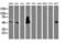 Sequestosome 1 antibody, LS-C337180, Lifespan Biosciences, Western Blot image 