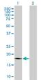 Protein Tyrosine Phosphatase 4A1 antibody, H00007803-B01P, Novus Biologicals, Western Blot image 