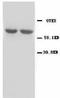 Glutamate Decarboxylase 1 antibody, LS-C171735, Lifespan Biosciences, Western Blot image 