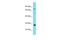 Proline And Serine Rich 3 antibody, A16383, Boster Biological Technology, Western Blot image 