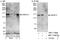 Ankyrin Repeat And Sterile Alpha Motif Domain Containing 1A antibody, NBP1-71806, Novus Biologicals, Western Blot image 