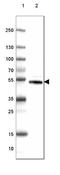 Dopa Decarboxylase antibody, NBP2-46642, Novus Biologicals, Western Blot image 