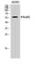 Interferon Alpha And Beta Receptor Subunit 2 antibody, A02056-1, Boster Biological Technology, Western Blot image 