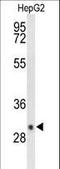 Iodothyronine Deiodinase 3 antibody, LS-C167418, Lifespan Biosciences, Western Blot image 