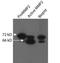 Matrix Metallopeptidase 2 antibody, NB200-114, Novus Biologicals, Western Blot image 