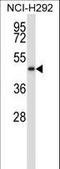 NAD Kinase 2, Mitochondrial antibody, LS-C168156, Lifespan Biosciences, Western Blot image 