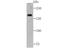 Bromodomain Adjacent To Zinc Finger Domain 1B antibody, NBP2-76878, Novus Biologicals, Western Blot image 