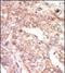 EPH Receptor A1 antibody, PA1-30290, Invitrogen Antibodies, Immunohistochemistry frozen image 