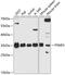 Proteasome Activator Subunit 3 antibody, 14-585, ProSci, Western Blot image 