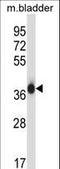 Eukaryotic Translation Initiation Factor 2 Subunit Alpha antibody, LS-B11819, Lifespan Biosciences, Western Blot image 