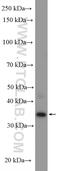 Coiled-Coil Domain Containing 92 antibody, 27192-1-AP, Proteintech Group, Western Blot image 