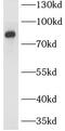 Solute Carrier Organic Anion Transporter Family Member 4C1 antibody, FNab07977, FineTest, Western Blot image 