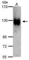 Progestagen Associated Endometrial Protein antibody, PA5-32247, Invitrogen Antibodies, Western Blot image 