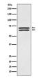 3-Phosphoinositide Dependent Protein Kinase 1 antibody, M01159, Boster Biological Technology, Western Blot image 