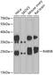 RAB5B, Member RAS Oncogene Family antibody, 22-947, ProSci, Western Blot image 