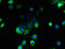 Major Facilitator Superfamily Domain Containing 1 antibody, LS-C397467, Lifespan Biosciences, Immunofluorescence image 