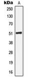 Keratin 16 antibody, LS-C352434, Lifespan Biosciences, Western Blot image 