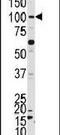 NIMA Related Kinase 4 antibody, PA5-15339, Invitrogen Antibodies, Western Blot image 