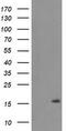 Transmembrane Protein 230 antibody, TA504919AM, Origene, Western Blot image 