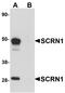 Secernin 1 antibody, A10002, Boster Biological Technology, Western Blot image 