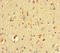 Serine Protease 12 antibody, LS-C679200, Lifespan Biosciences, Immunohistochemistry paraffin image 