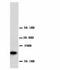 Glutathione S-transferase P 1 antibody, LS-C171747, Lifespan Biosciences, Western Blot image 
