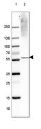 Solute Carrier Family 17 Member 7 antibody, NBP2-46627, Novus Biologicals, Western Blot image 