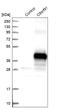 Transmembrane Protein 268 antibody, HPA017199, Atlas Antibodies, Western Blot image 