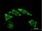 Insulin Like Growth Factor 2 MRNA Binding Protein 2 antibody, H00010644-B01P, Novus Biologicals, Immunocytochemistry image 