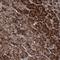 Coiled-Coil Serine Rich Protein 2 antibody, HPA037482, Atlas Antibodies, Immunohistochemistry paraffin image 